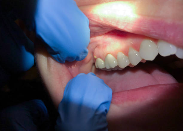 Best Walk-In Emergency Dental Services in Oak Park, MI