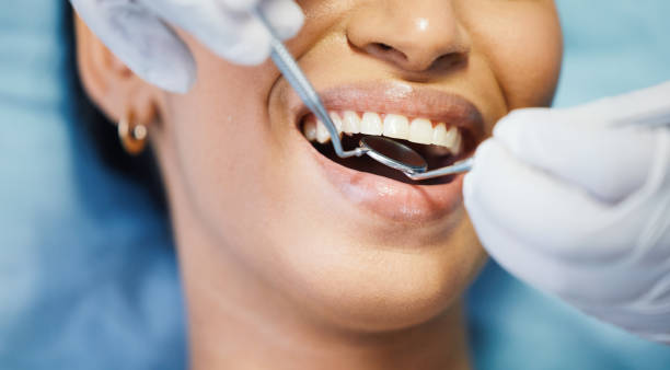 Best Broken or Chipped Tooth Repair in Oak Park, MI